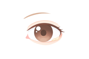 目尻に目やにが付いた目のイラスト｜目のトラブル・衛生ケア素材（透過PNG・商用OK）