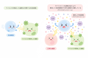 免疫細胞が感染細胞を攻撃するイラストとサイトカインストームの解説｜ウイルス感染・過剰免疫反応素材（透過PNG・商用OK）