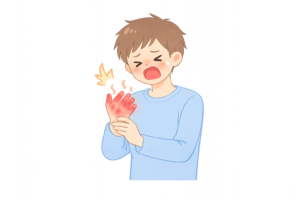火傷で赤くなった手のイラスト｜やけど・痛み・注意喚起の医療素材（透過PNG・商用OK）